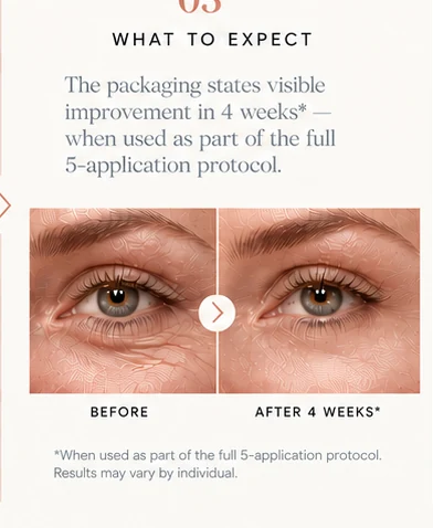 What to expect: an illustrative before-and-after-4-weeks comparison of the eye area, with the note that results may vary by individual.
